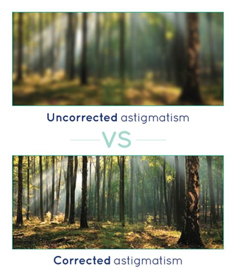 Astigmatismo