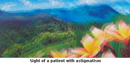 Astigmatismo