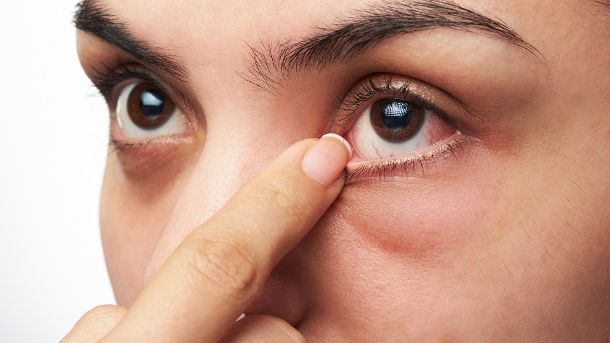 lentes de contato grudam nos olhos