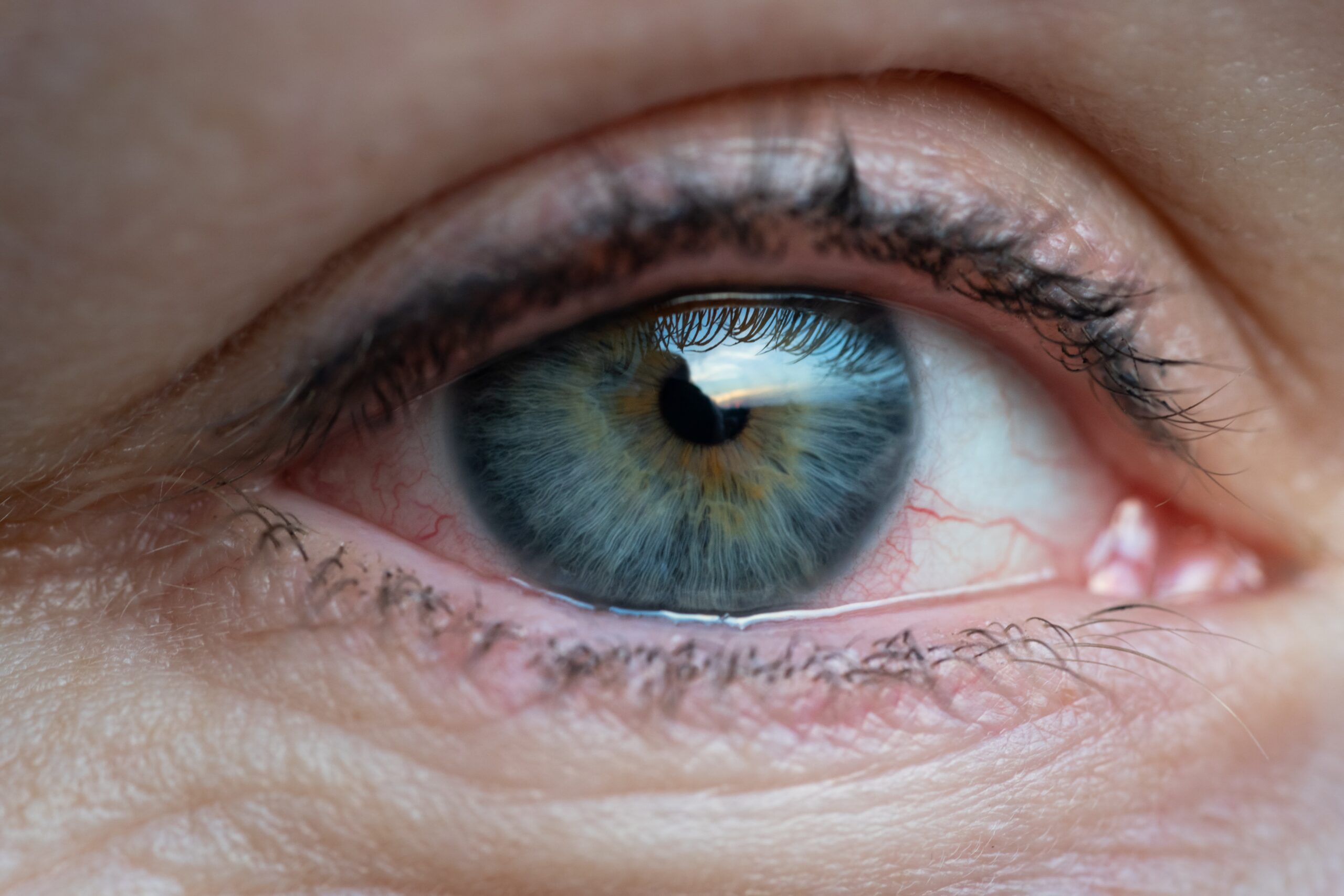 Olhos ressecados: quais as causas e como evitar