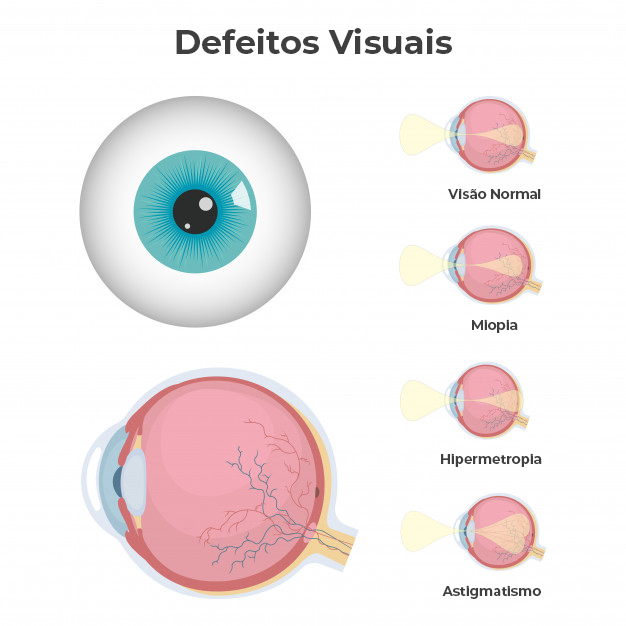 Conheça Os 4 Principais Tipos De Problemas De Visão